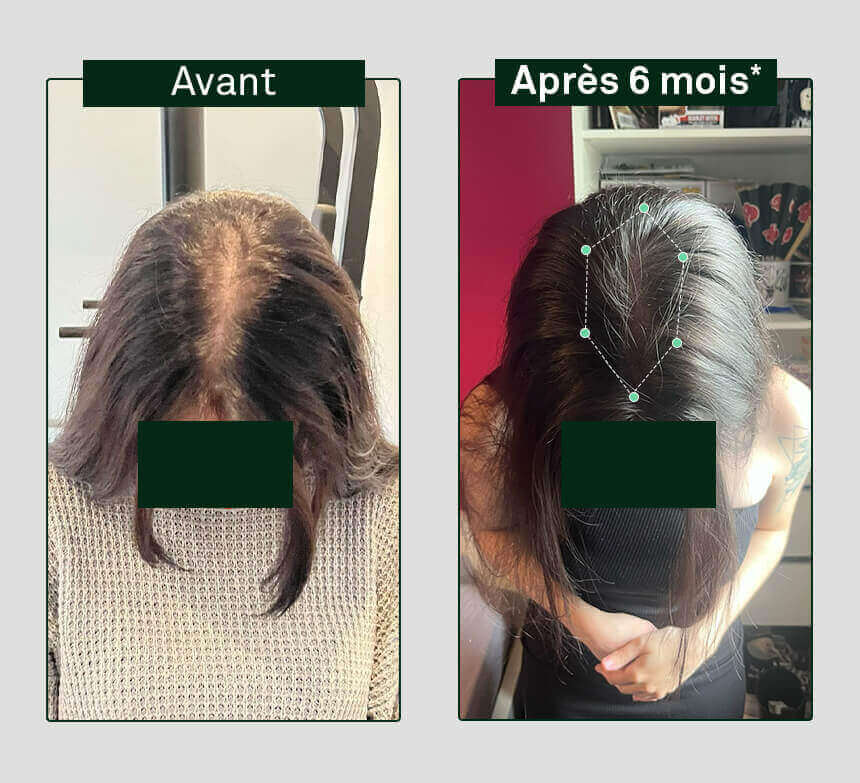 brote-crecimiento-fortificación-x3
